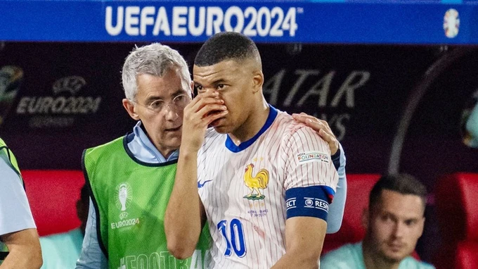 Mbappe tránh được phải phẫu thuật mũi